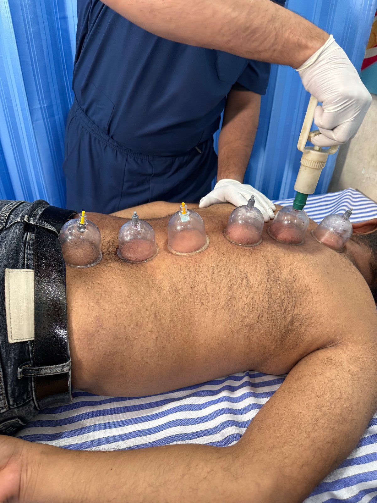 Exercise therapy session for physiotherapy rehabilitation in Jaipur