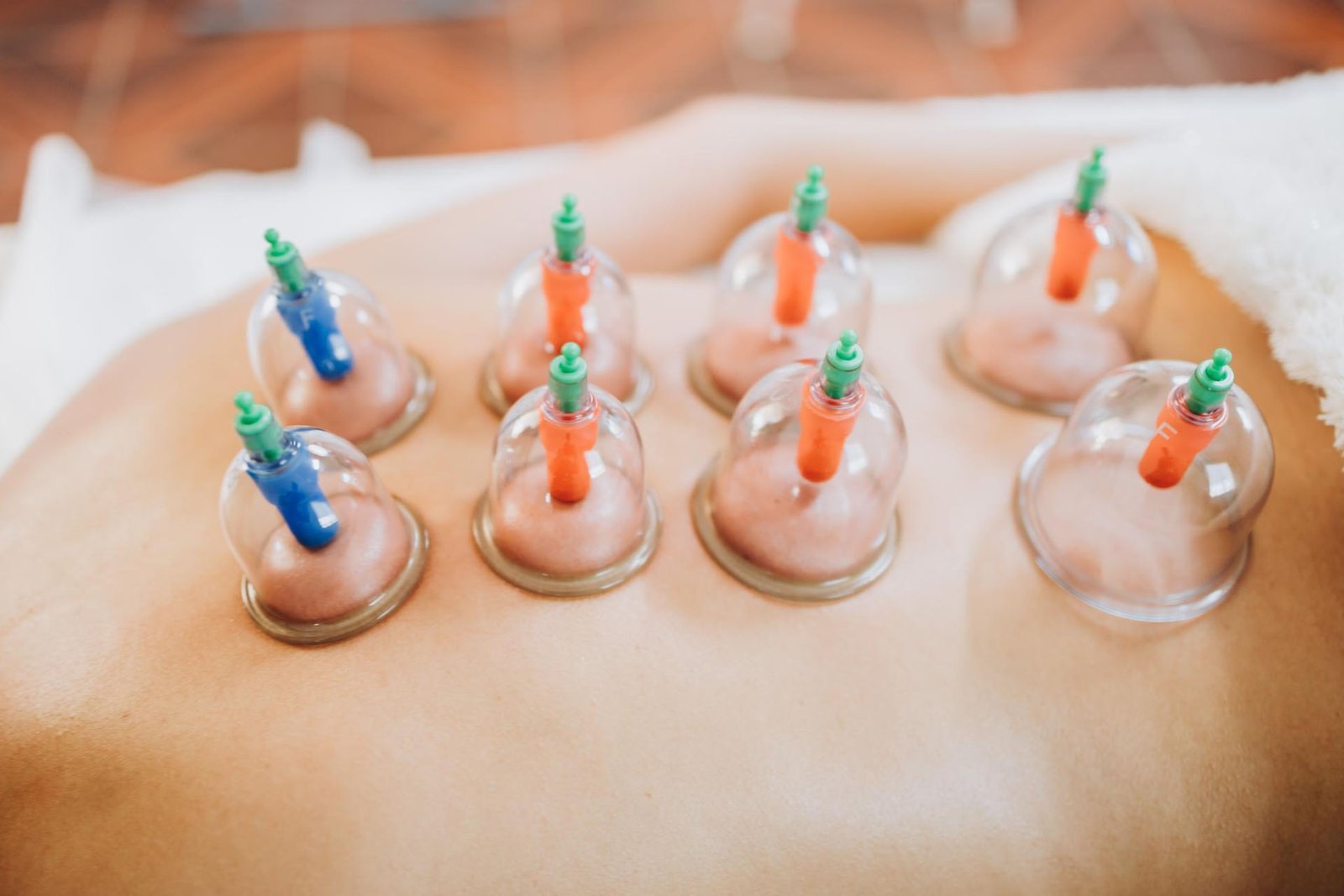 Cupping & IASTM Therapy